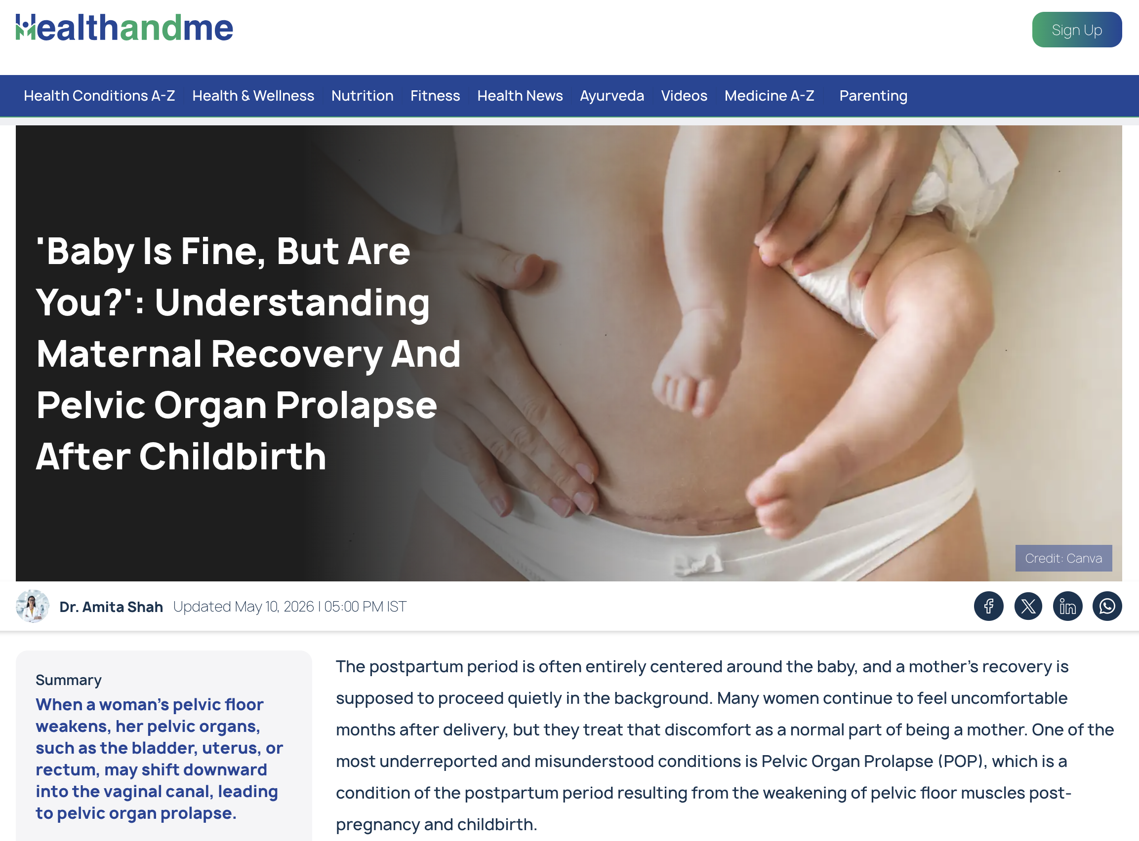 Understanding Maternal Recovery And Pelvic Organ Prolapse After Childbirth